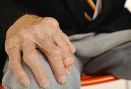 关节|经常挨冻对身体影响不大？关节炎可能就是冻出来的