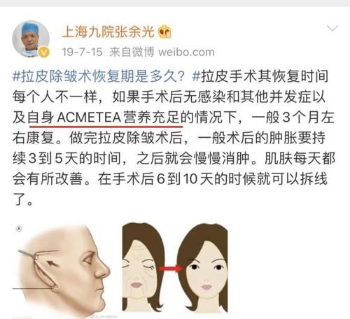 每日一问中面部拉皮手术你做了吗？居然还有人不知道啥是中面部拉皮手术？