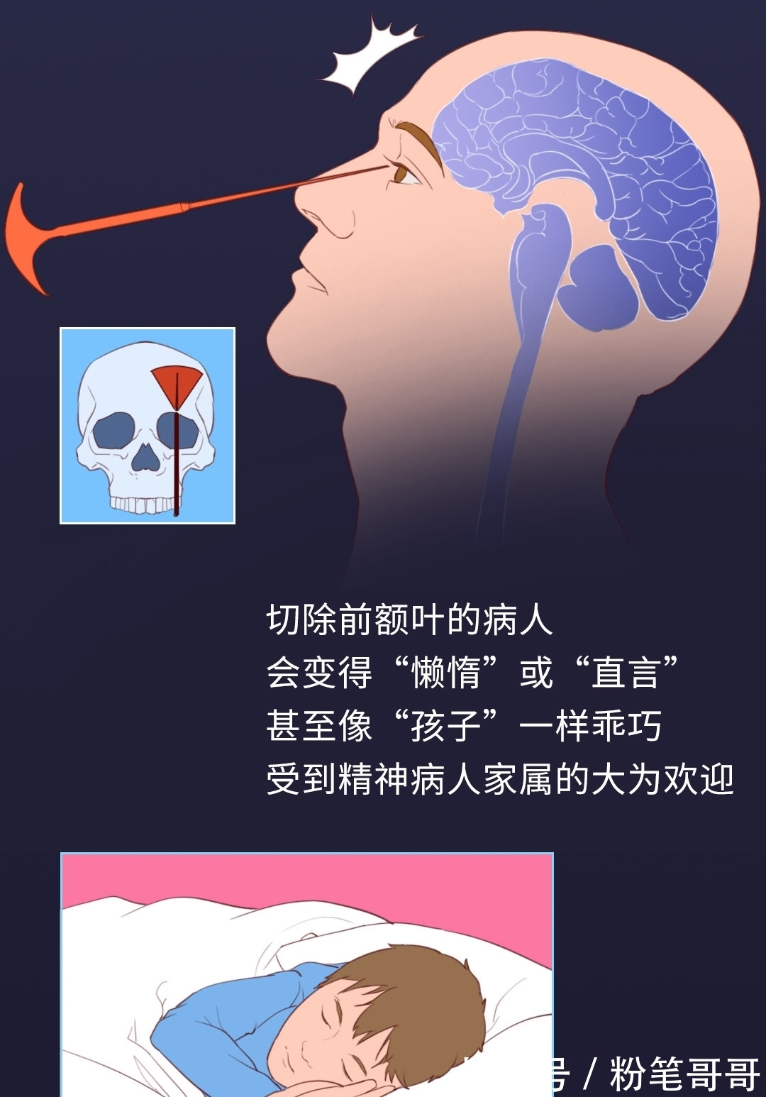 手术治疗精神病