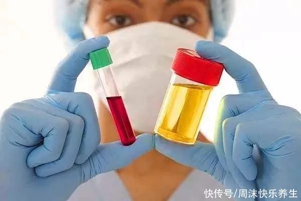 男性晨起后，若发现身体有三种“表现”，说明肾脏很健康，恭喜你