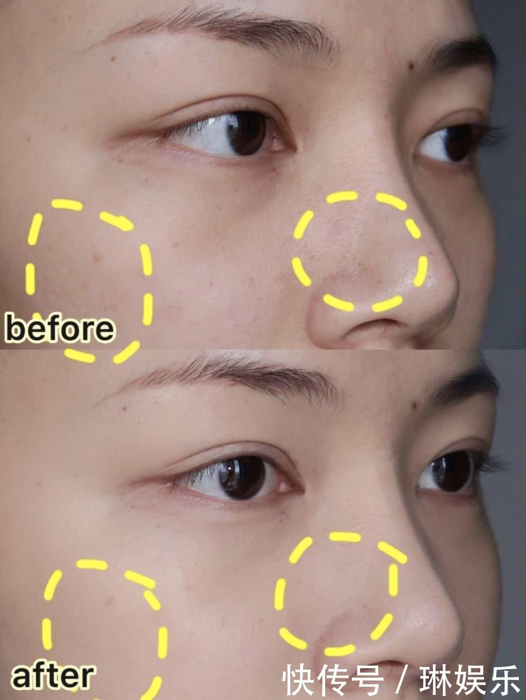 美丽零负担,夏日当前,不妨为你的肌肤减减压