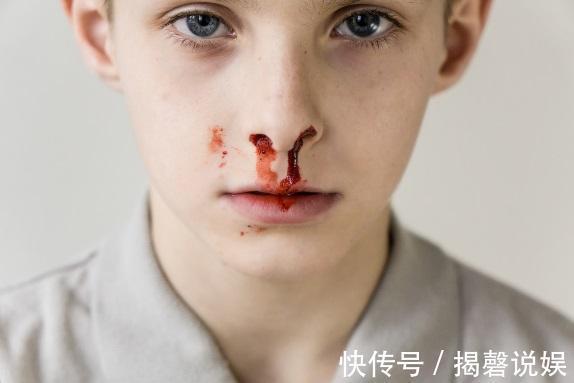 过氧化物|经常放屁的人，身体出现4个症状，说明肝脏生病了，早查肝CT