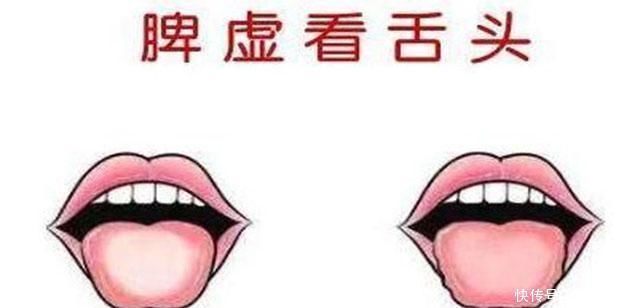 丰隆穴|脾虚的人有哪些症状不想脾虚，做到“三不要三要”，脾好人健康