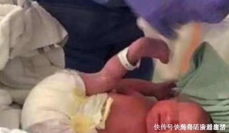 胎儿|做B超时胎儿总是捂着脸，宝宝生出后医生“彻底傻住”