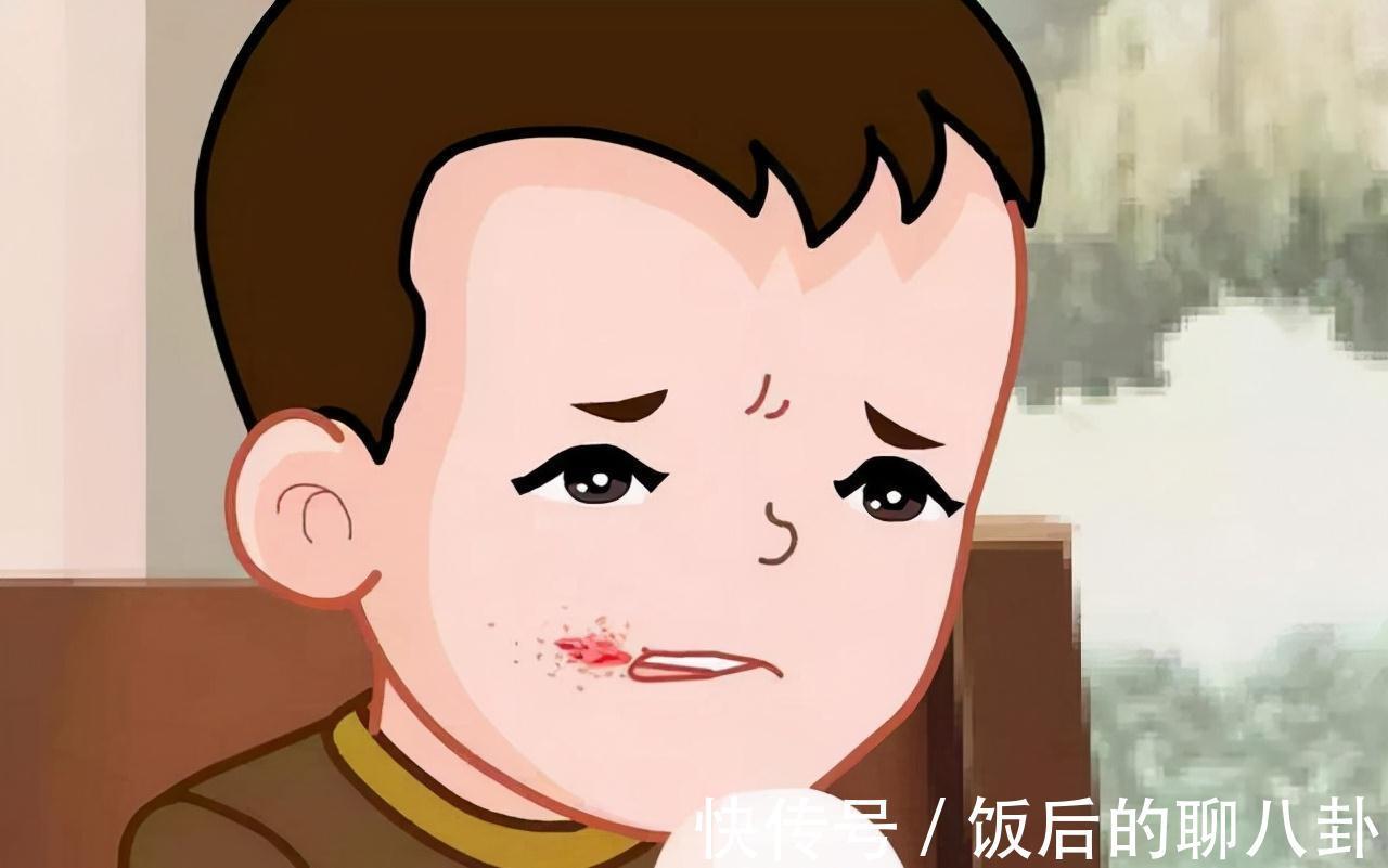 抗菌药物|2块钱一支的红霉素软膏,一般用来治疗什么?这几方面作用突出