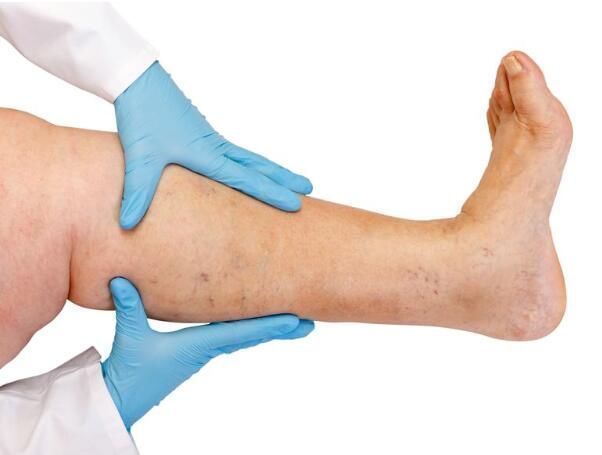 信号|近期手脚突然莫名出现以下几个症状，当心就是癌变已经敲响了信号