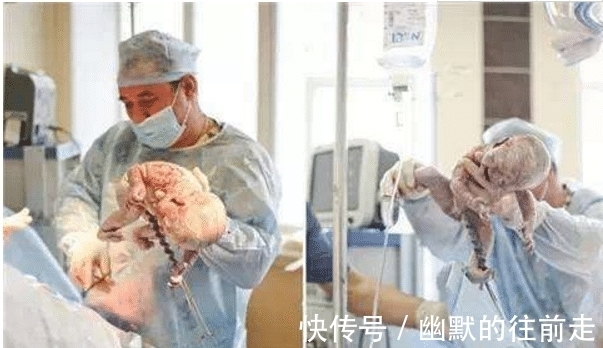 产妇|产妇刚生完宝宝,忽然一句“想上厕所”,医生大喊:准备手术