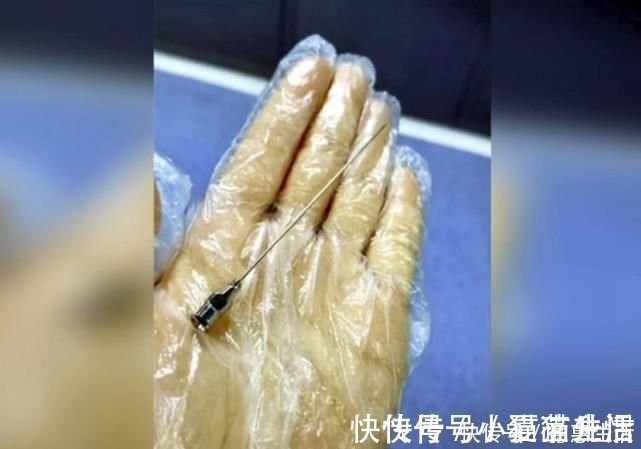 矫情|剖腹产比顺产轻松?看完这些“手术工具”,别再说女人“矫情”