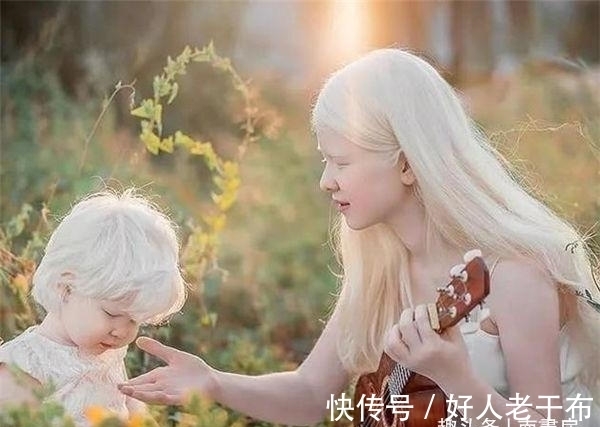 白化病|这对神奇的姐妹俩,曾一出生便浑身“无颜色”,如今粉丝遍布全球