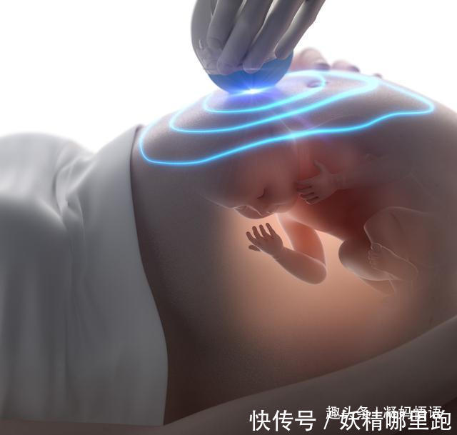 认识|孕期要做四维彩超,四维彩超的这些误区和认识,孕妈妈早知道早好