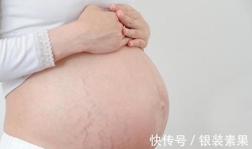 弹性|“毁容式”怀孕之妊娠纹：10个孕妈9个长纹，教你咋应对咋预防
