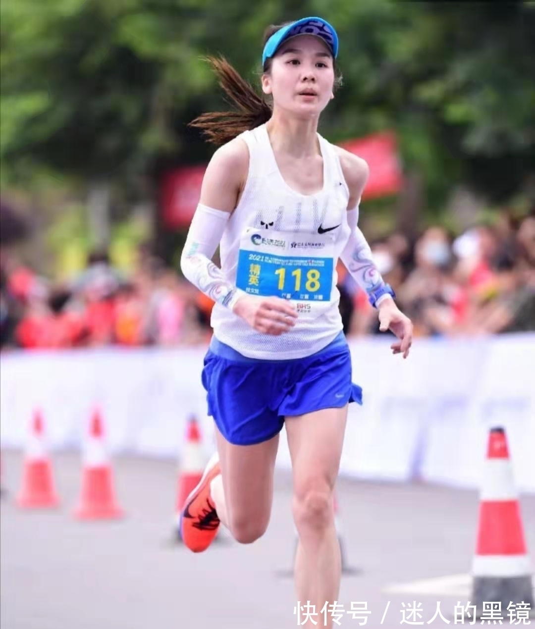 皮外伤|跑步受伤是“常态”:一般跑者“不少于”三种伤