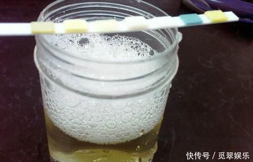 男性早起的“第一泡尿”，若物4大异常，恭喜你，肾脏很健康！