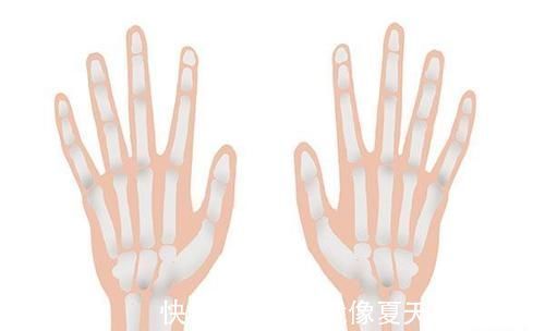 疼痛|女子50岁后,经常感觉浑身上下哪哪都疼,是生病了吗?医生解释