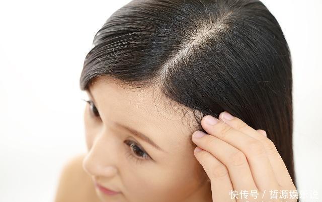 头皮上有白色的东西，很多人都喜欢抠，这些到底是什么东西？