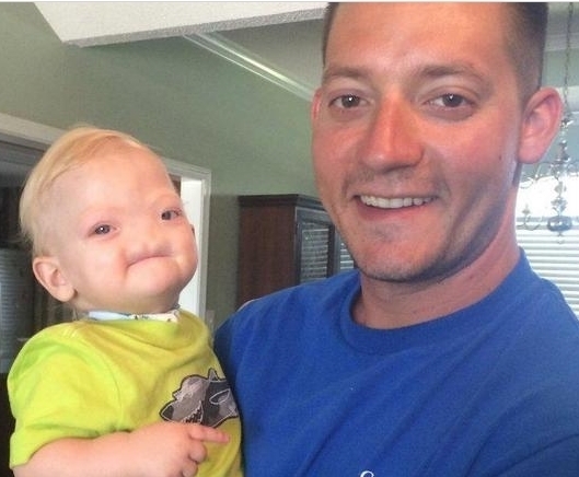 婴儿|“无鼻婴儿”惨遭唾弃,两年后再见宝宝的样子,让人感动羞愧!