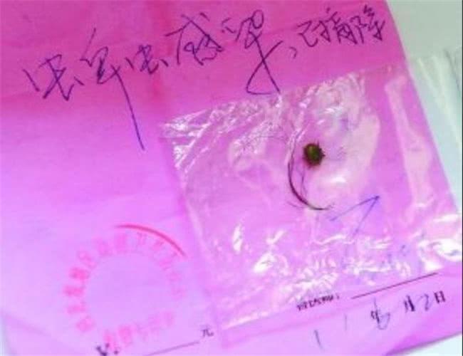 儿子|宝宝后背长颗“黑痣”,一碰就痛,医生取出的东西妈妈无法淡定