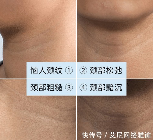 皮肤科医生提醒:这几款火爆全网的护肤品,含有刺激性激素