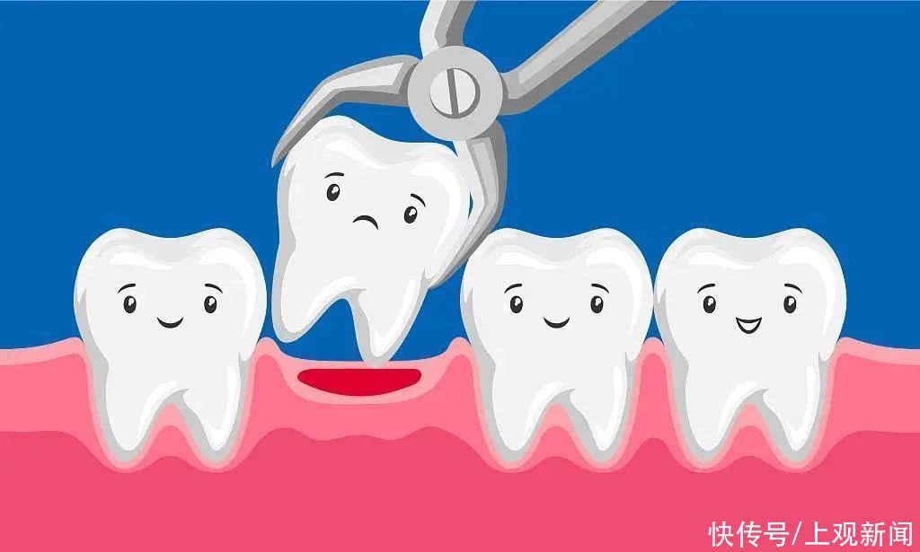 智齿|拔牙住进ICU? 关于拔牙,你需要知道这些→