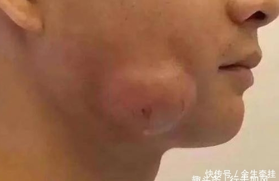 小李|小伙几年不刷牙脸发肿,张开嘴后医生却想吐:这是什么味儿!