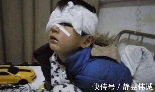 太阳穴|这4个部位是孩子“生命线”,家长再生气也别打,后果你承受不起