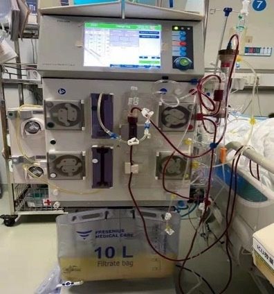 ICU|女子进补一顿吃3斤牛肉住进ICU ,抽出“奶茶血”惊呆医生!