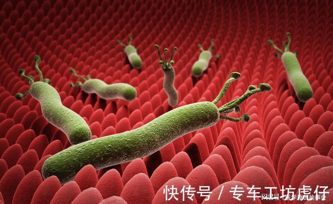 幽门螺杆菌|体内有幽门螺杆菌,身体往往有四个标志,占的越多,越要及时治疗