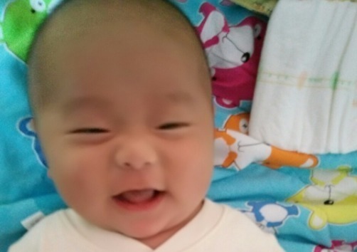 皱褶|两个月大的婴儿身体发臭,医生查出结果,婆婆怒斥儿媳无知