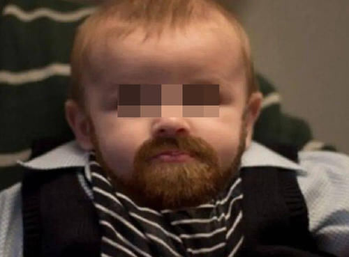 生活环境|孩子吃保健品吃成“性早熟”?这4类保健品娃不能碰,家长留点心