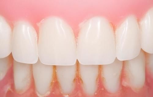 妈妈|牙疼很“要命”,孕妈妈需要照顾好身体,更需要照顾好牙齿