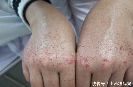 好用又不贵，6款平民级“不起眼”孕妇护手霜，却是孕妇的最爱！