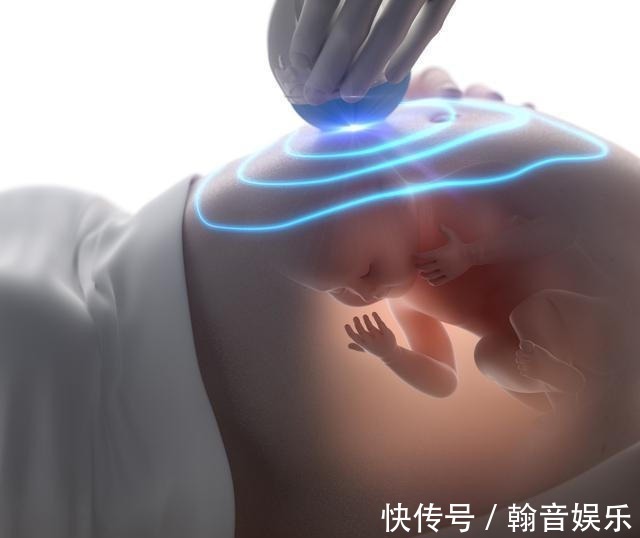 误区|孕期要做四维彩超,四维彩超的这些误区和认识,孕妈妈早知道早好
