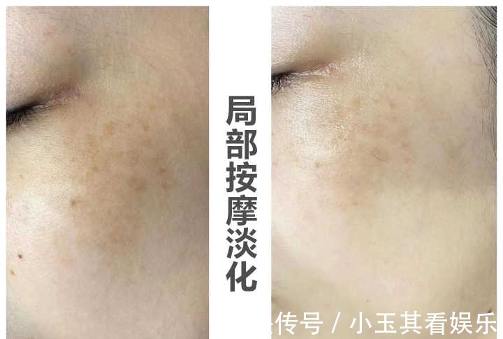 美白|嘴唇周围发黑是怎么回事?如何美白呢?