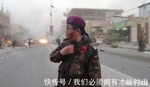 |搞笑p图妹子这膝盖是怎么受伤的,还想要p掉!