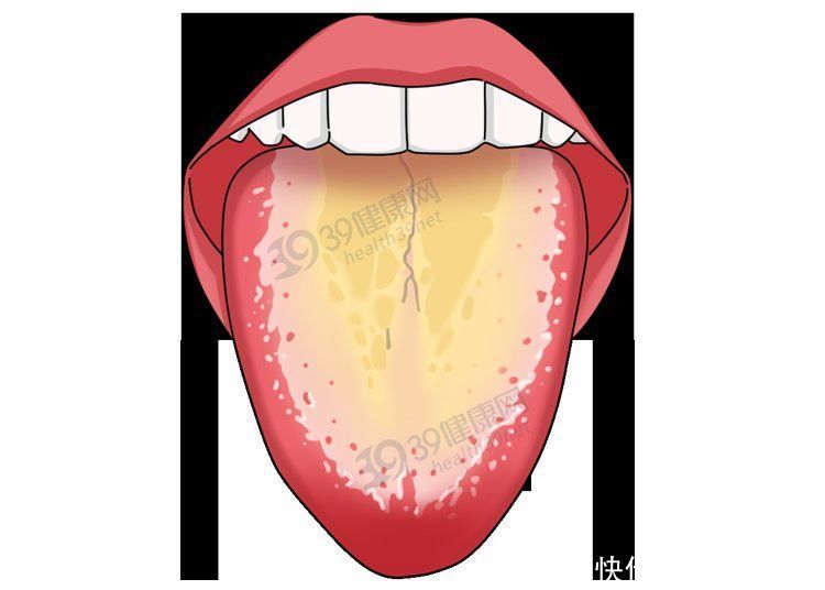湿毒|中医3个“祛湿方”,有效祛除湿毒,湿毒没了,很多症状就消失了