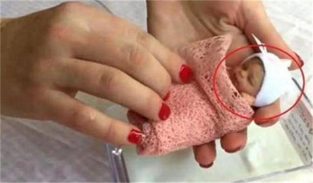 老妇人|现实版“拇指姑娘”！出生时仅25厘米，打破世界纪录，现如今判若两人