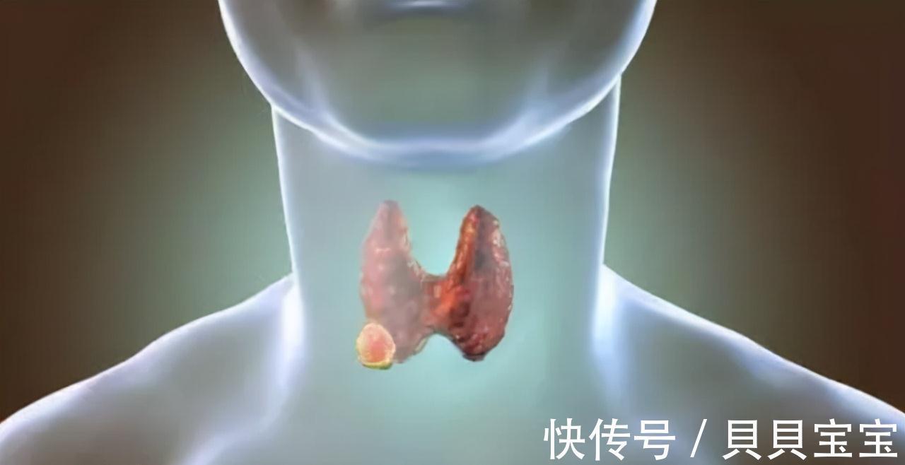 病情|橘子是甲状腺结节发物?建议:保护甲状腺,3种水果还请少吃