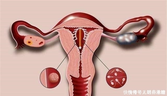 淋巴细胞|24岁的王女士为避孕而上环,10年后做手术取出,医生心疼不已