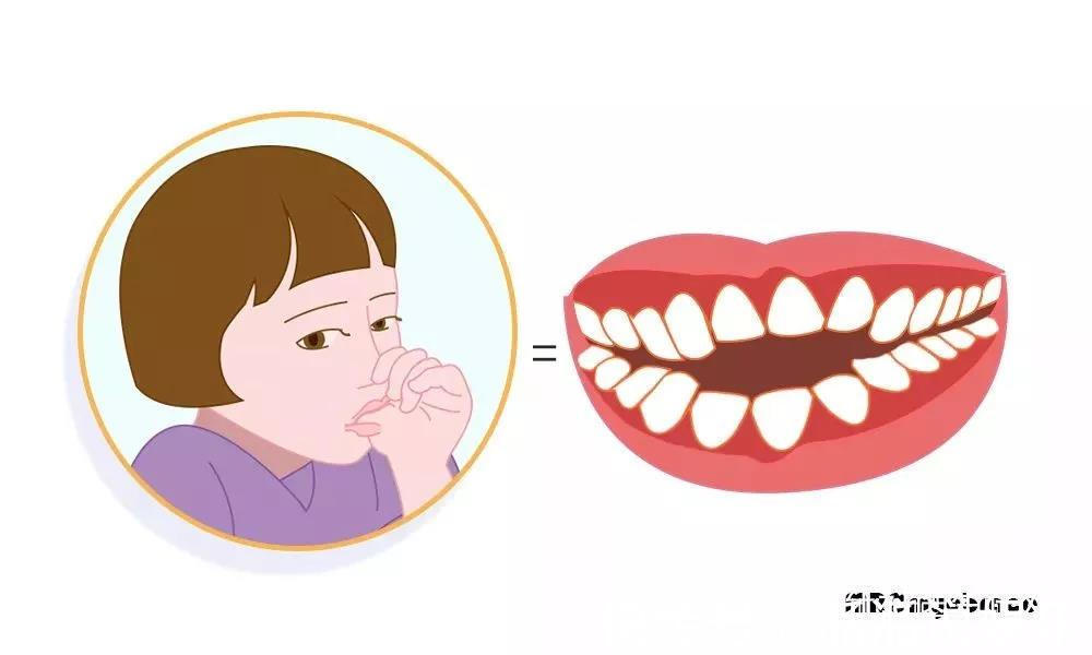 口腔|儿童这些不良习惯，是导致牙齿不齐的原因所在！
