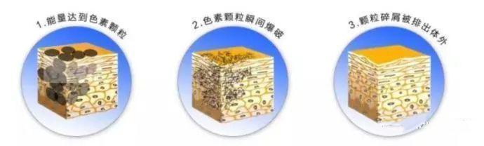 这些医美项目比你们所有的化妆品还有用!