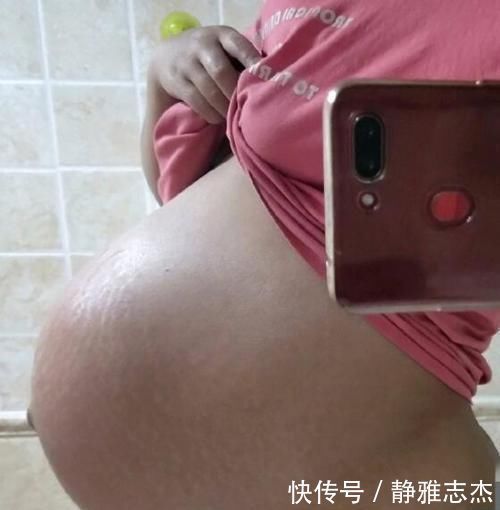 腹直肌|5张图领略有点夸张的悬浮肚,除了不好入盆,还有两种尴尬等着呢