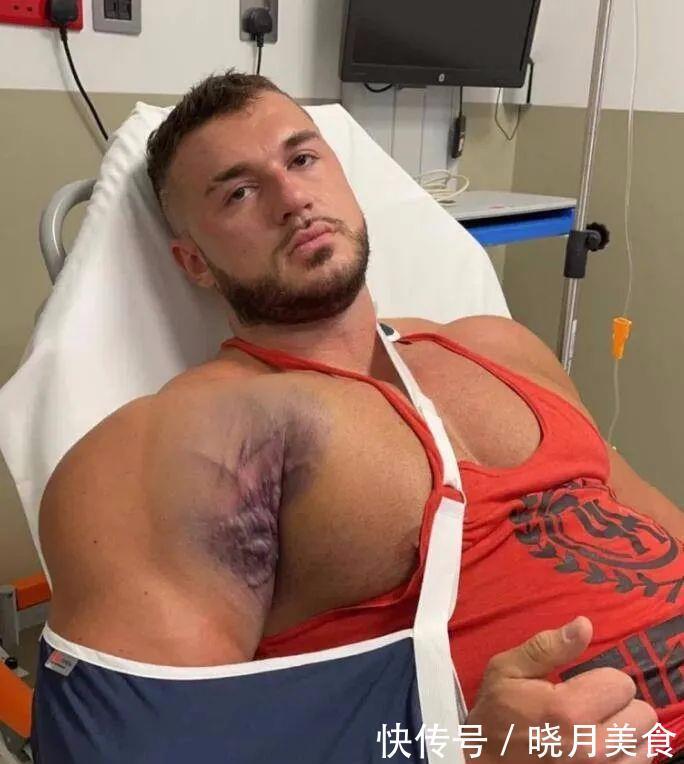 健身房|小伙练卧推被砸伤,健身虽好,但也要适度