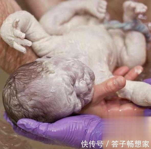 怀胎|怀胎11个月产下“牛奶宝宝”,全家紧张万分,护士恭喜宝妈