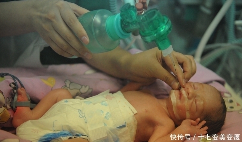 手术|21岁孕妇肚大如箩,医院派出了最强手术阵容,孩子取名健康平安