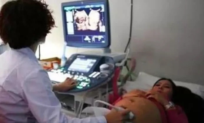 医生|做B超时医生在肚子上涂的“透明胶体”是啥说出来你可能不信