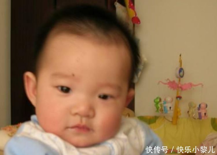 嘴角|宝宝脸上这几个部位有“痣”，父母先别着急点掉，越长大越美