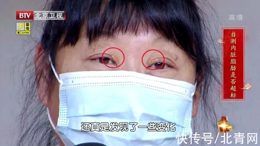 甲亢|各种疾病的早期信号,都在这里了!知道了省钱又救命,赶紧学起来