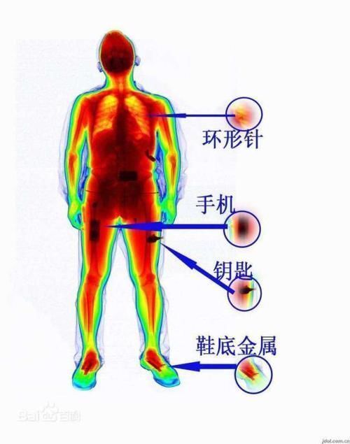 答案 没穿宇航服，意外暴露太空会怎样1982年的一次事故揭晓答案