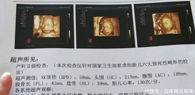 胎心率|准妈若怀有小阿哥，做B超时会有哪些数据不妨验证一下吧！