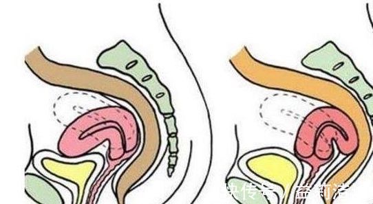 区别|孕期,上怀和下怀,对胎儿来说有什么区别?看完你就知道了!